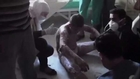 Amateur videos show Syrian burn victims