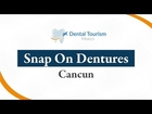 Snap On Dentures Dental Implants Cancun