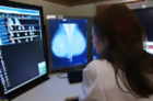 Study: More Women Opting for Preventive Double Mastectomy