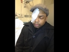 WARNING!!! BLACK MAN CLAIMS MOB ATTACK BY JEWISH MEN IN BROOKLYN KNOCKOUT