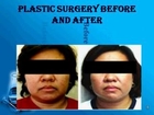 Enhance your face and figure with plastic surgery